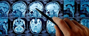 Brain Injury